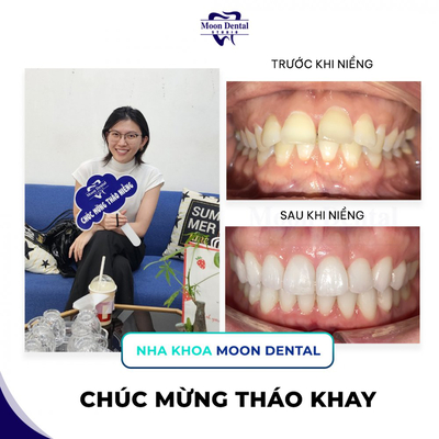Slider image (1) Nha Khoa Moon - Dental Clinic in Vietnam
